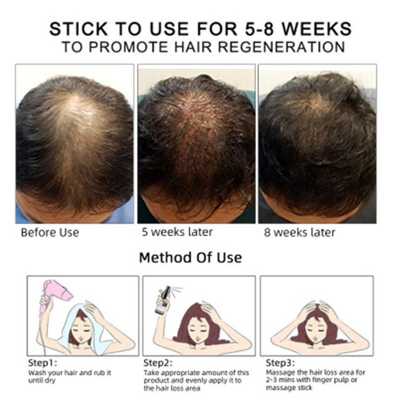 Hair Growth Oil Hair Growth Oil Oem Hair Care Essential Oil null