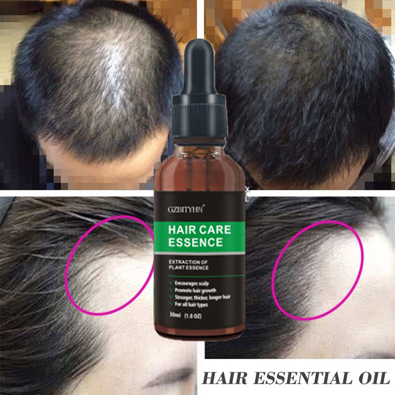 Hair Growth Oil Hair Growth Oil Oem Hair Care Essential Oil null