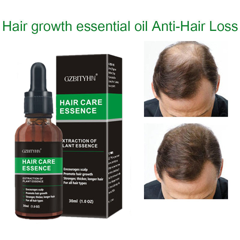 Hair Growth Oil Hair Growth Oil Oem Hair Care Essential Oil null