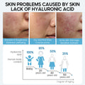 Hyaluronic Acid Face Serum Anti-Aging Shrink Pore Whitening Moisturizing Face Cream Dry Skin Care null
