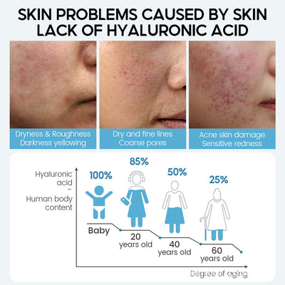 Hyaluronic Acid Face Serum Anti-Aging Shrink Pore Whitening Moisturizing Face Cream Dry Skin Care null